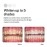 Opalescence PF 10% Teeth Whitening 8pk (Latest Product)