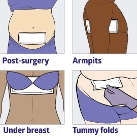 Medline MSC10614Z Ultrasorbs Skin Moisture Management Dry Sheet, 6 x 14 (Pack of 10)