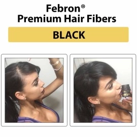 FEBRON Hair Fibers For Thinning Hair BLACK Giant 30G For Women & Men Hair Loss Concealer Hair Powder Volumizing Based 100% Undetectable & Natural - Bold Spots Filler