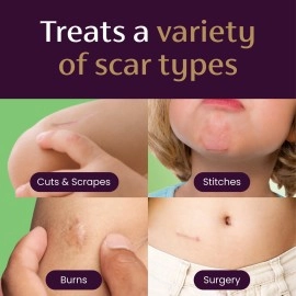 Mederma Scar Gel for Kids, Reduces the Appearance of Scars, 1 Pediatrician Recommended, Goes on Purple, Rubs in Clear, Kid Friendly, Grape Scent, 0.70 Oz