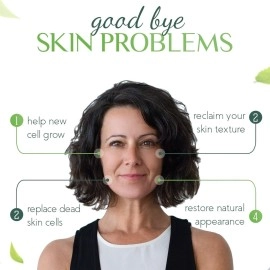 Dr Speron\'s Natural Skincare Scar Removal Cream For New & Old Scars, Advanced Silicone Scar Gel For Surgical Scars, Pimples, Burns, And Dark Spots - 1.41oz