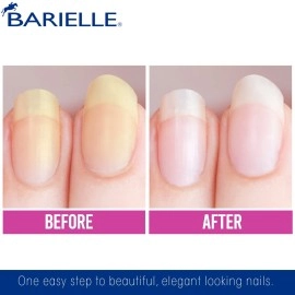 Barielle Nail Whitener for Yellow Nails or Dull Nails .47 Ounce - Whitening for Nails, Treats Yellow Nails