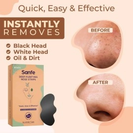 Sanfe Deep Purifying Nose Strips for Women - Pack of 3 with Fuji Green Tea & Witch Hazel extracts | Removes Whiteheads | Blackheads and cleanses pores | Use on Nose