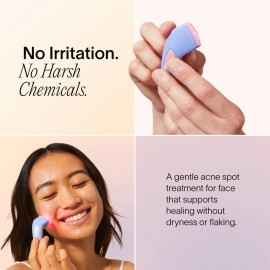 Solawave Bye Acne Spot Treatment, Red Light Therapy and Blue Light Therapy, Use Before Pimple Patches. Acne Light Device, Face Care Must-Have