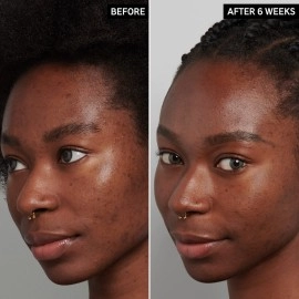 The Inkey List Tranexamic Acid Serum