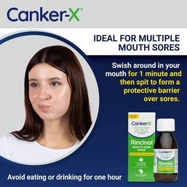 Canker-X Rincinol Oral Rinse Mouthwash, Quick Pain Relief from Canker Sores, Mouth Burns & More, Benzocaine Free & Alcohol Free Mouthwash, Adults & 6 Years+ Kids Mouthwash, 4.0 Fl. Oz.
