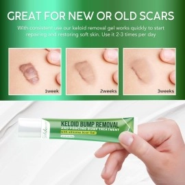 Advanced Keloid Scar Removal Gel: Silicone Bump Removal Cream for Scars from Piercing, Surgical Marks, Acne, and Burns - Effective Keloid Treatment for Ears, Face, and Body with Healing Formula